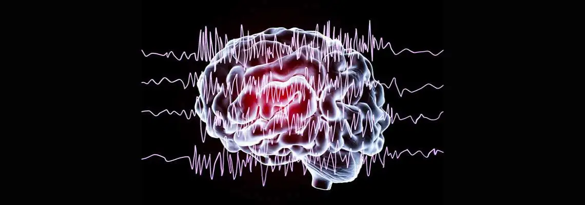 Crise Convulsiva - Noções Crise Convulsiva - Noções
